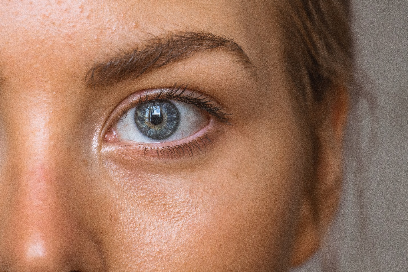 allergy types